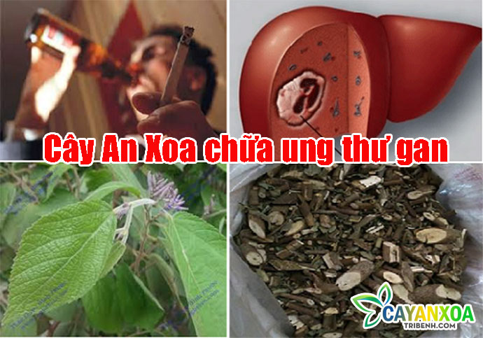 dieu-tri-ung-thu-gan-bang-cay-an-xoa