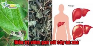 dieu-tri-viem-gan-voi-cay-an-xoa