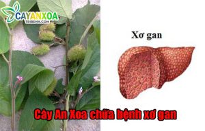 dieu-tri-xo-gan-bang-cay-an-xoa