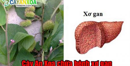 dieu-tri-xo-gan-bang-cay-an-xoa