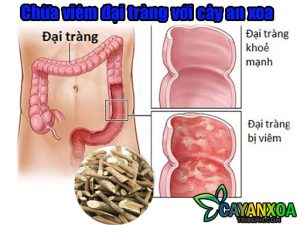 chua-viem-dai-trang-voi-cay-an-xoa-1